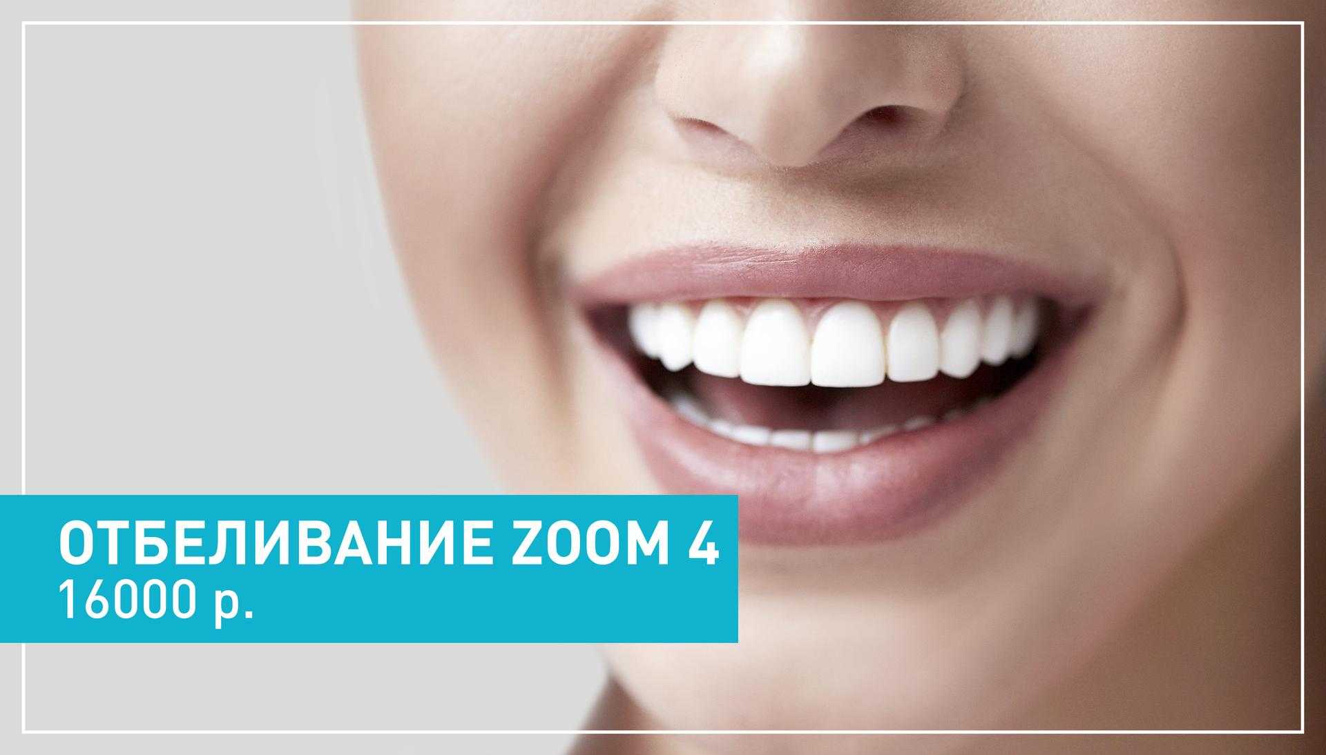 Франшиза отбеливание зубов