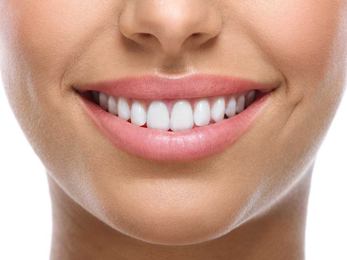 White-smile