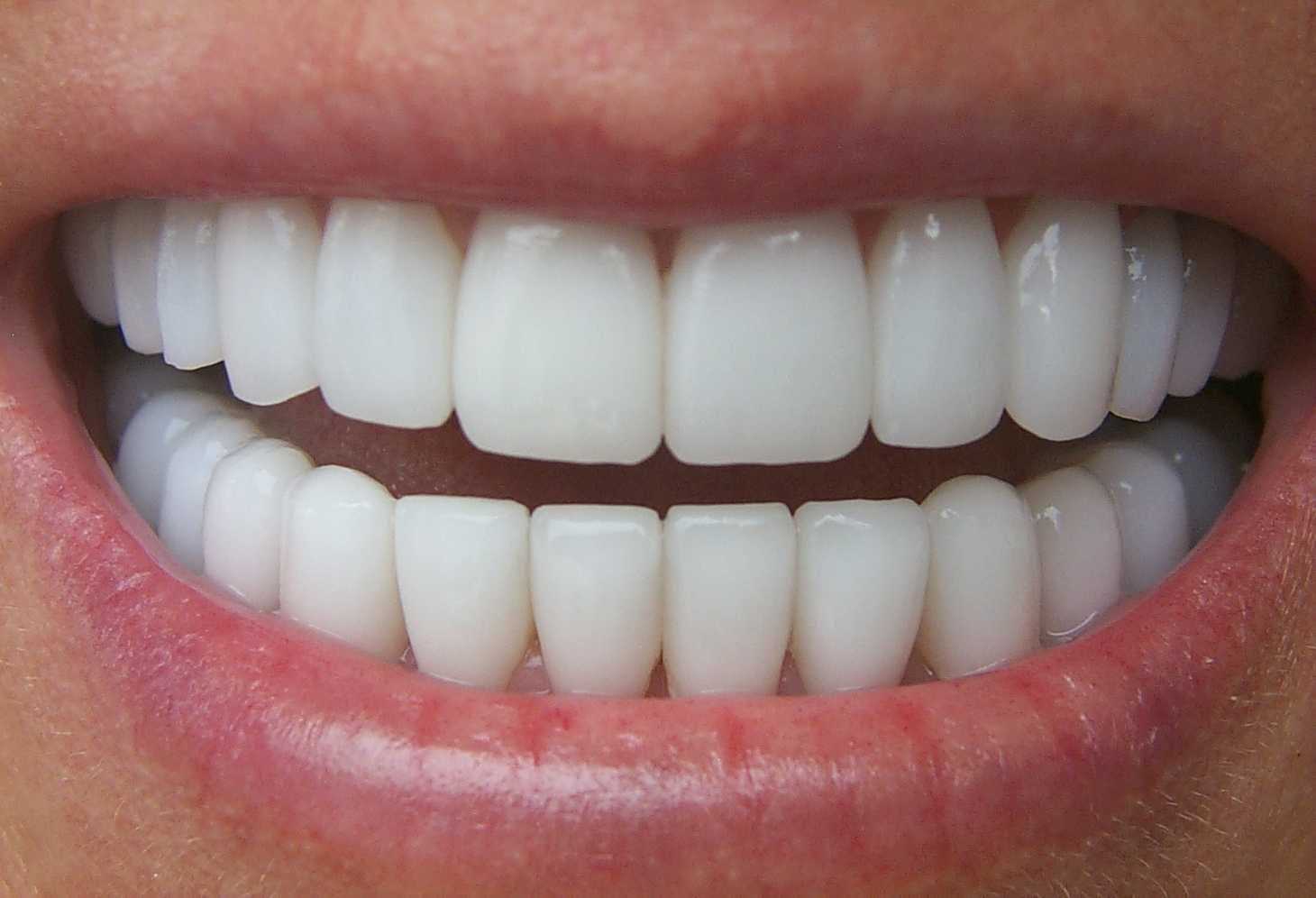 Смайл рум отбеливание зубов отзывы франшиза – франшиза smile room отзывы и стоимость